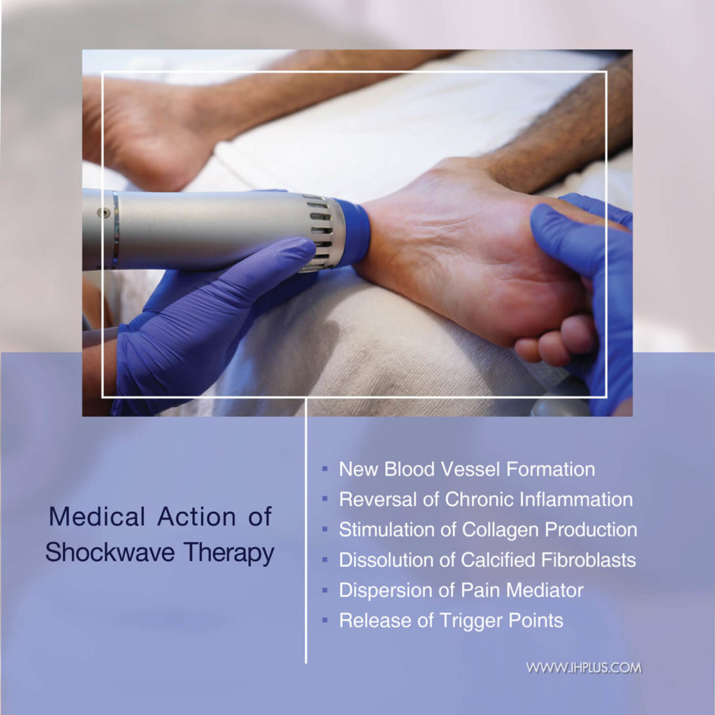 ShockWave Therapy Intellihealth Plus Rejuvenation Clinic