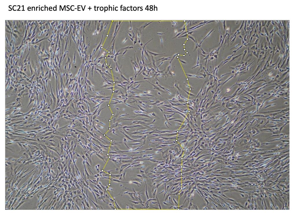 SC21 negative control MSC-EV | intellihealthplus clinic by stemcells21