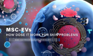 How MSC-EVs Work for Skin Problems, MSC-EVs, MSC exosome,