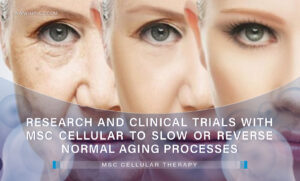 Research and clinical trials with MSC Cellular to slow or reverse normal aging processes