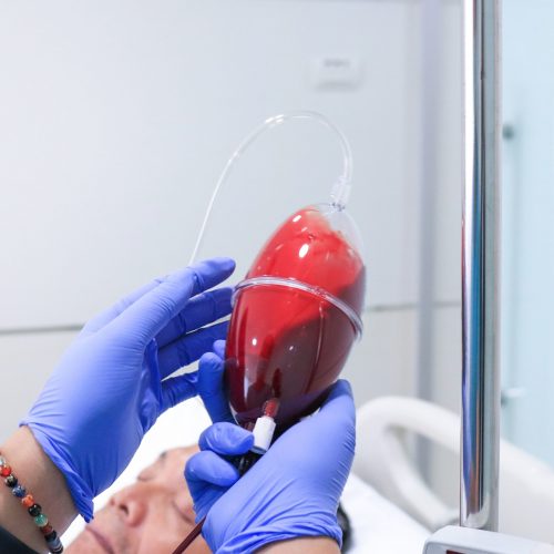Ozone therapy 2 Ozone therapy 2